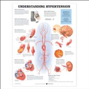   Hypertension Anatomical Chart 20 X 26 Health & Personal Care