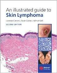 An Illustrated Guide to Skin Lymphoma, (1405113766), Lorenzo Cerroni 